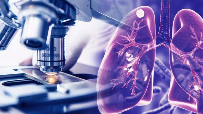 Observatório de Tuberculose desenvolve estratégias inovadoras de combate à doença